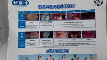 成人涂氟方法视频播放,视频教程详解