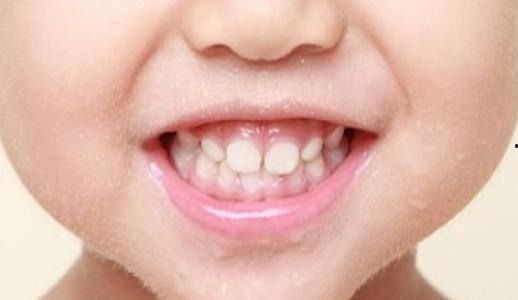 成人怎样定期护理牙齿视频